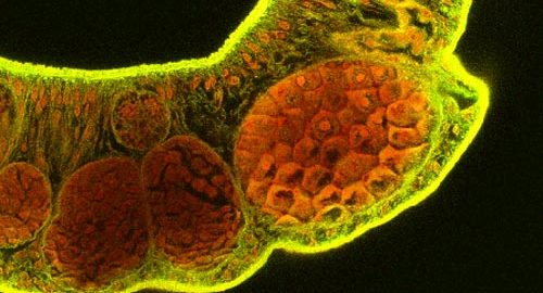 Image shows a fluorescence microscopy image of a parasite, with cells stained bright orange and yellow. The background is black.